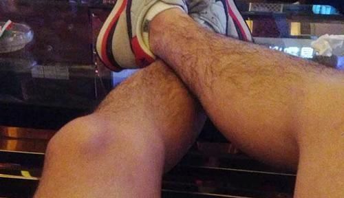 预防血栓|血栓“上身”,腿先知坦言多吃两物,清血管,预防血管堵塞