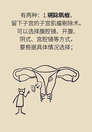 切除|得了子宫肌瘤就一定要切除？看看医生怎么说