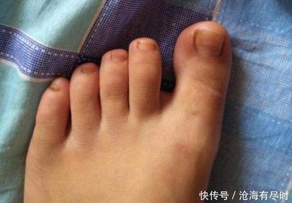 睡前先用艾叶泡脚,三天泡一次,时间长了3个“毛病”泡没了