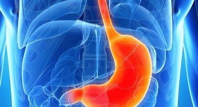 癌细胞|胃癌通常是“拖”出来的! 若饭后常有这4种表现, 建议及早检查!
