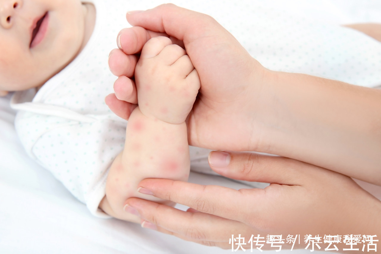 布洛芬|孩子发烧别着急，38.5℃以下自行处理，3个降温方法快速退烧