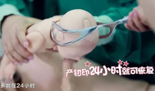 医生|6个月宝宝产钳印明显,奶奶找医生“算账”,医生的话让她脸红