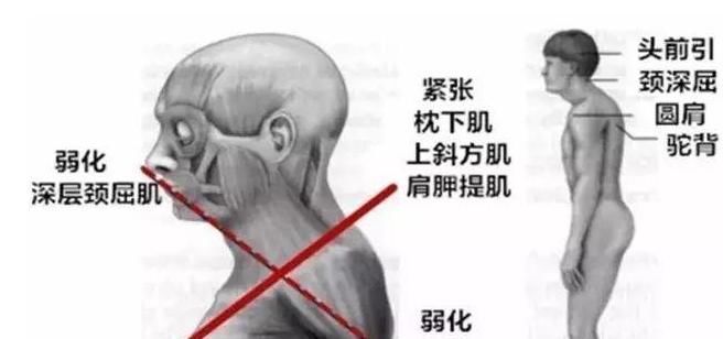 楼梯|专业人士提醒不想关节提前报废,7件事别乱做,能改一件是福