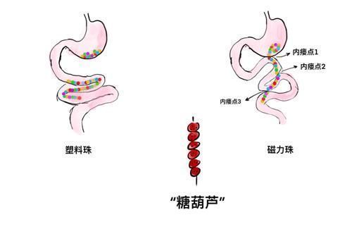 兰兰|别让所谓的“益智”玩具,毁掉孩子的健康