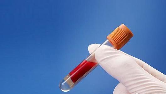 垃圾食品|几种你爱吃的食物,其实都是垃圾食品有面、有汤,还有午餐肉