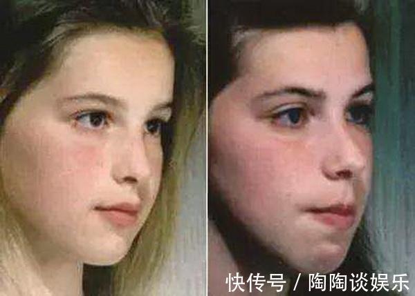 牙弓|孩子睡前的一个坏习惯,正悄悄毁掉自身颜值,很多父母还没察觉到