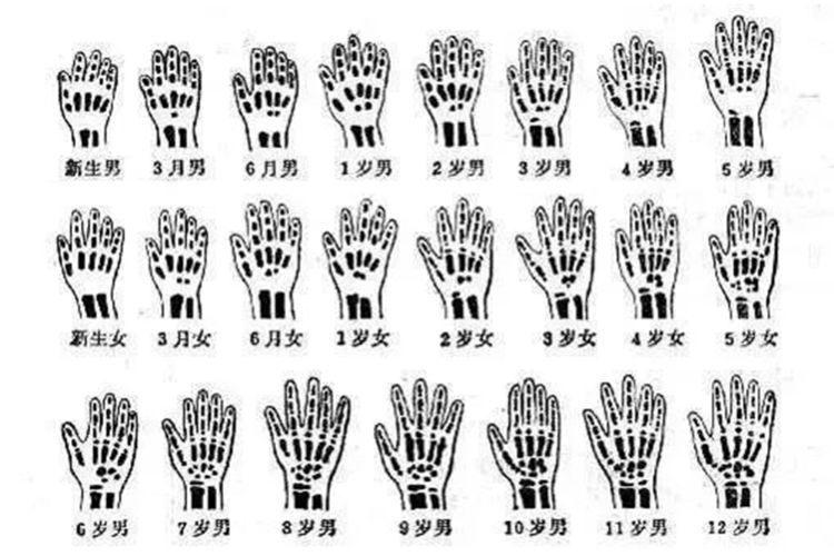 孩子|身高矮的孩子如果有几种表现,家长无需担心,将来会是“大高个”