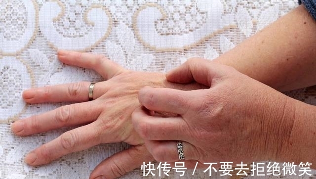 酮症酸中毒|研究发现新的糖尿病因!医生提醒:反复出现这1现象需警惕糖尿病