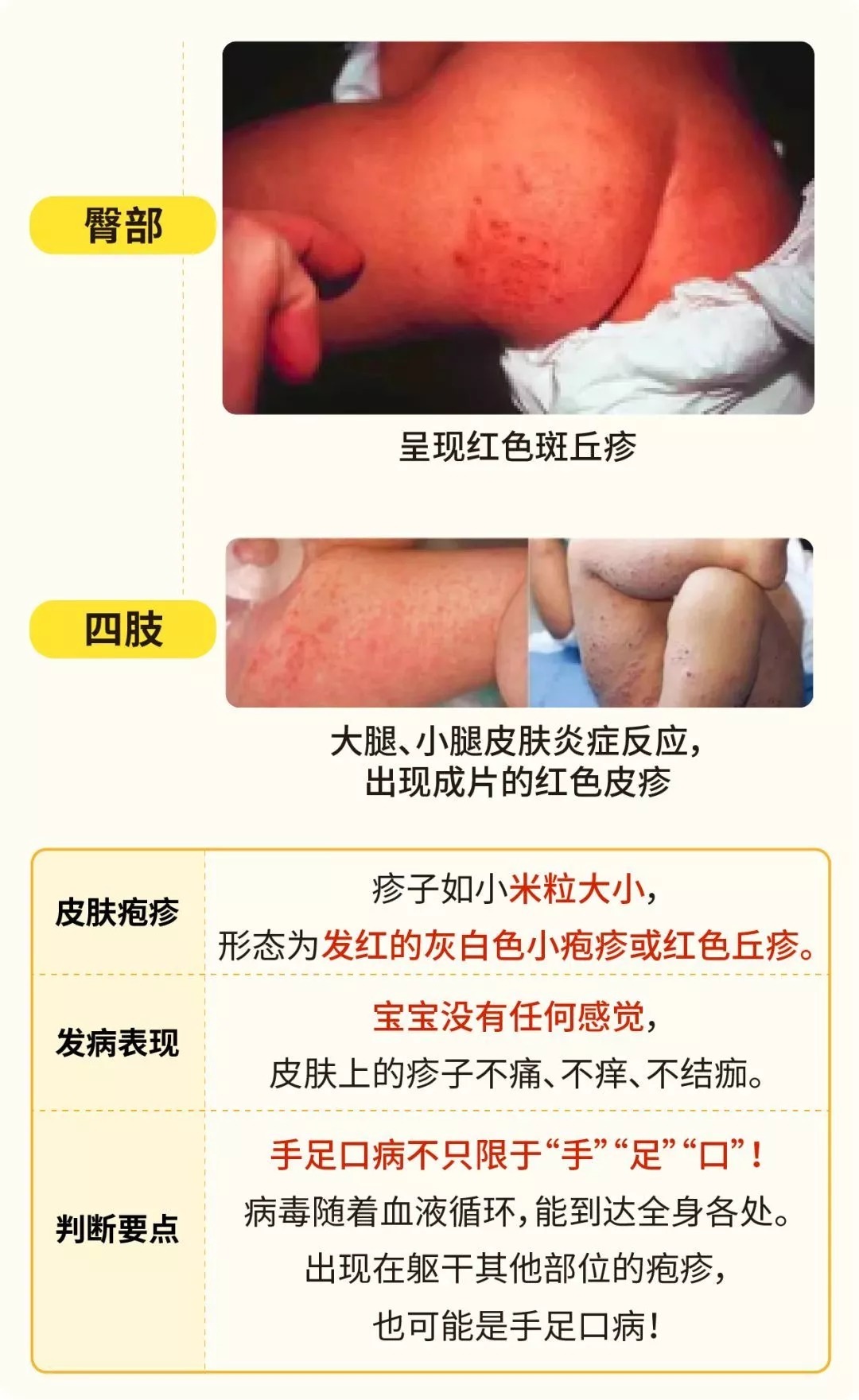 杨俊|柳州已有班级停课!这种传染病进入高发期,如何预防、护理看这→