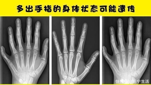 感受器 虽然很有趣,但并不是每个人都听说过的7个冷知识