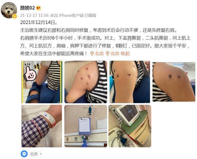 中国女排|8颗钉植入右肩,颜妮手术顺利报平安,她是中国女排永远的北长城