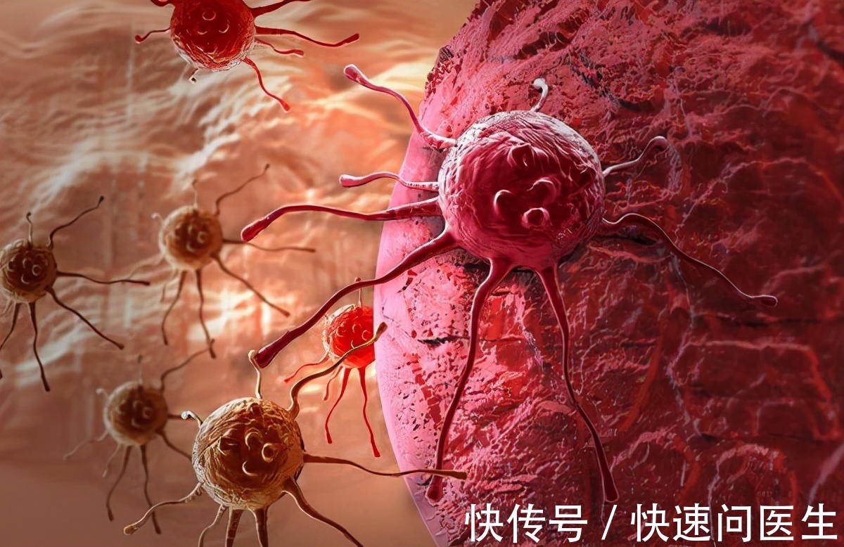 慢性疾病|未来不想让癌症找上自己，现在起做好5件事，或能预防癌症