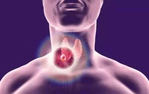 食物|为什么会产生“结节”？生活中以下食物尽量少吃，或可避免结节