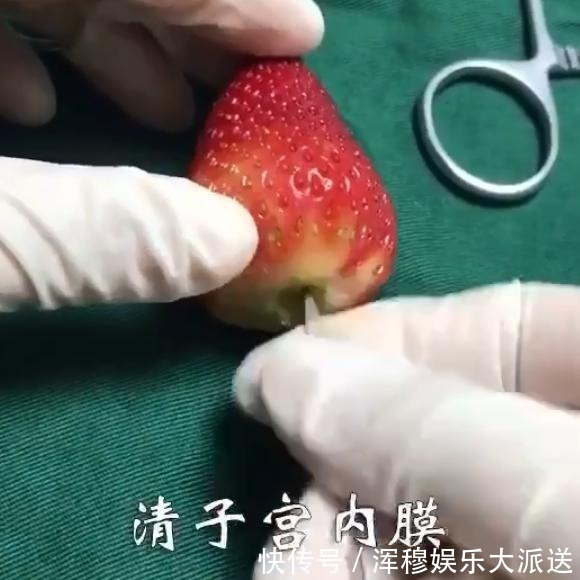 伤害|“人流”对女性伤害有多大 医生用草莓“演示”人流过程