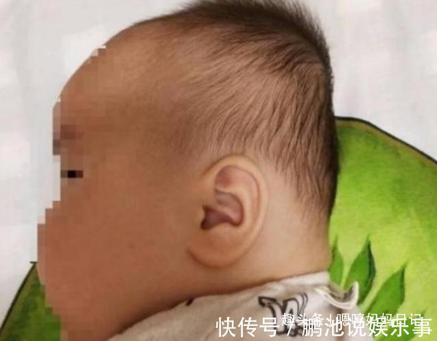 宝宝|小时睡枕头和不睡枕头的孩子,长大后头型和骨骼差距明显,得注意