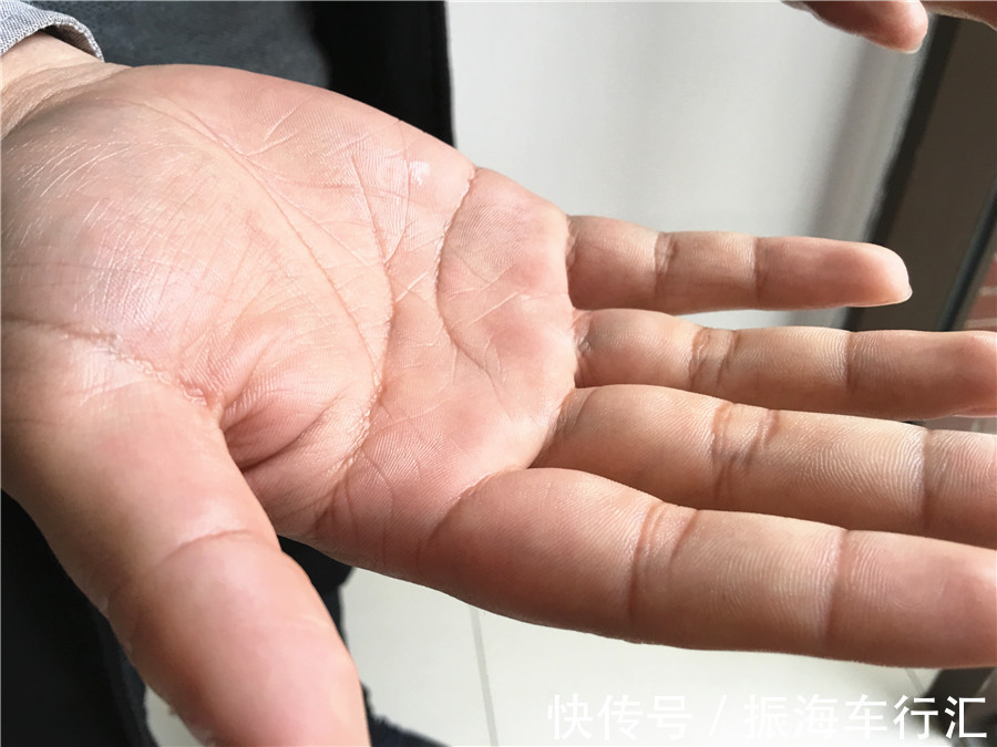 阳虚者|如何判别自己是阳虚还是阴虚?不要乱补,搞错了适得其反