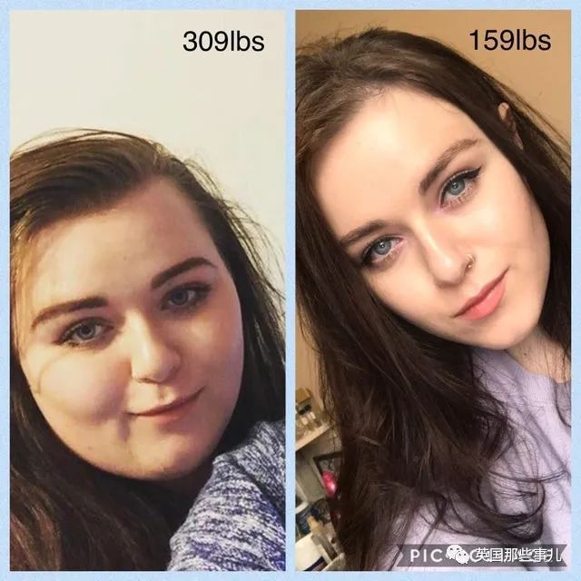 精气神|一个姑娘减掉230斤是什么样子…对比照惊到我了
