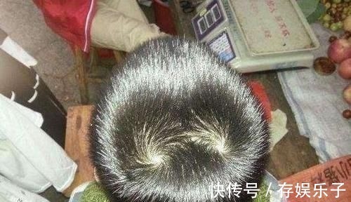 小伟|孩子头顶几个旋暗示着什么?别乱猜,科学的解释爸妈要牢记