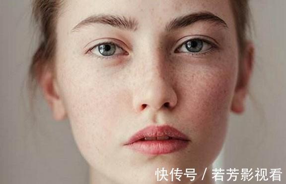 油条|这3种食物女人要少吃,面部容易长斑,衰老快