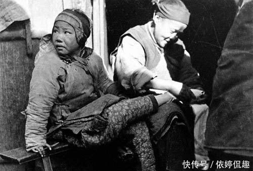 陋习|因美而生的陋习:束腰和黑齿,一个挤坏器官,一个吓哭小孩