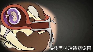 胎儿|孕妇被迫引产,腹中胎儿有感觉吗?看完这些画面,后悔得掩面痛哭