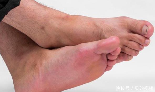 开关|脚上有一个“化血栓开关”,睡前按一按,有效清血毒,防血栓