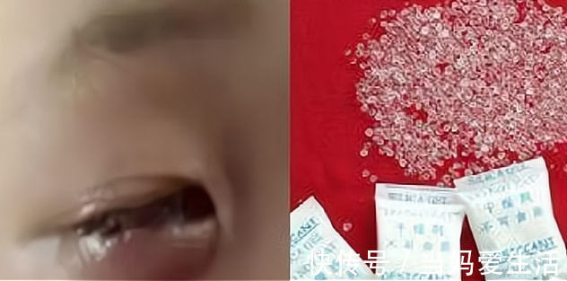 包装袋|别让孩子拿它当“玩具”,小心眼球“被融”,家里有的抓紧仍