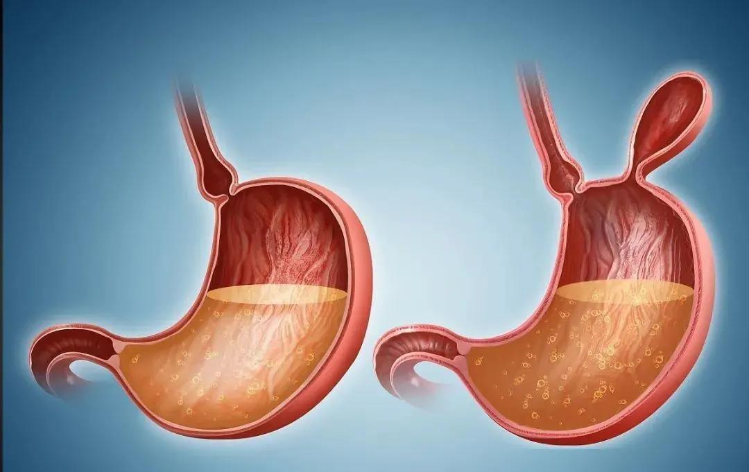 癌前病变|六大常见癌症如何早期筛查?