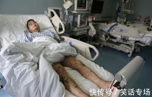 高热卡|胰腺癌多是“拖”出来的，若身体有1种痛感，趁早去医院检查一下