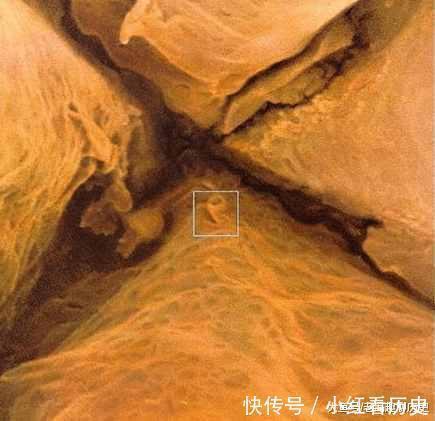 把我们的皮肤放大一亿倍,最后“超乎想象”