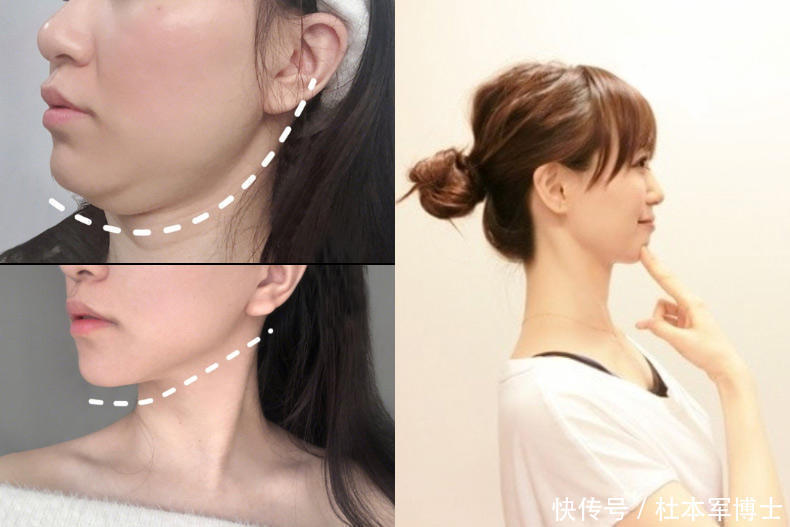 水肿问题|告别大圆脸,快速有效,看这3个【瘦脸法则】