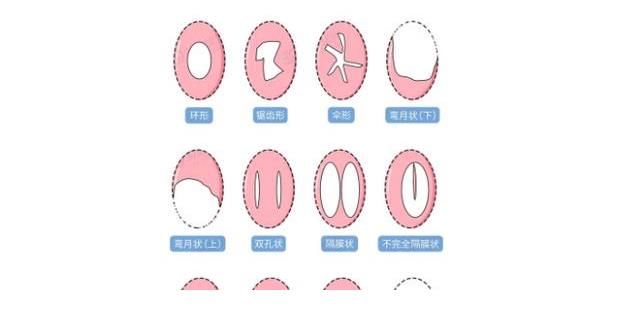 生长发育|处女能检查出来吗？那层膜到底有什么用？女孩们要好好保护自己