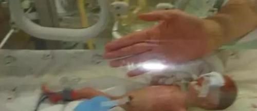 死神|出生轰动全国,14年前体重不足500克的“早产儿”,现在咋样了