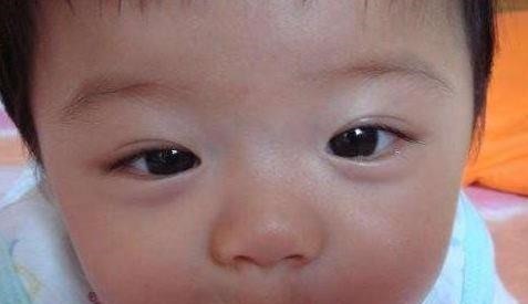 脾虚|5岁男童脾胃功能“衰退”,医生:3种习惯,是娃积食的“元凶”