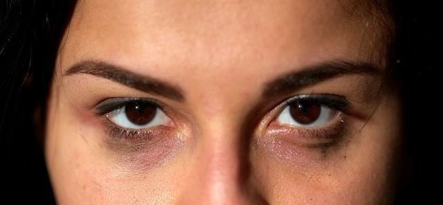 湿气|天然的“祛湿王”,每天来1杯,湿气排得一干二净,体重也轻了