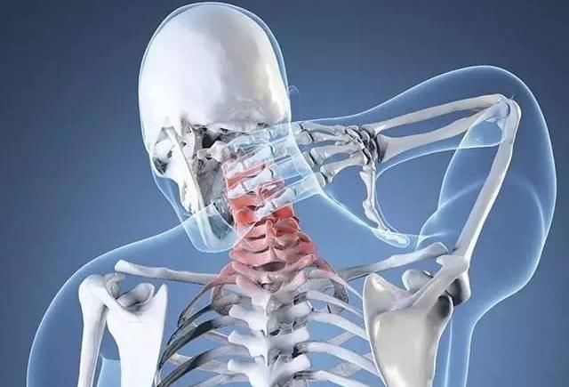 肩部|颈椎病“病在颈椎，伤在全身”，教你一个自我治疗绝活，马上搞起