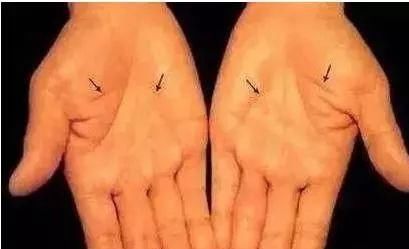 收藏|流傳幾百年的手診歌訣，面診歌訣，一看就會，果斷收藏！