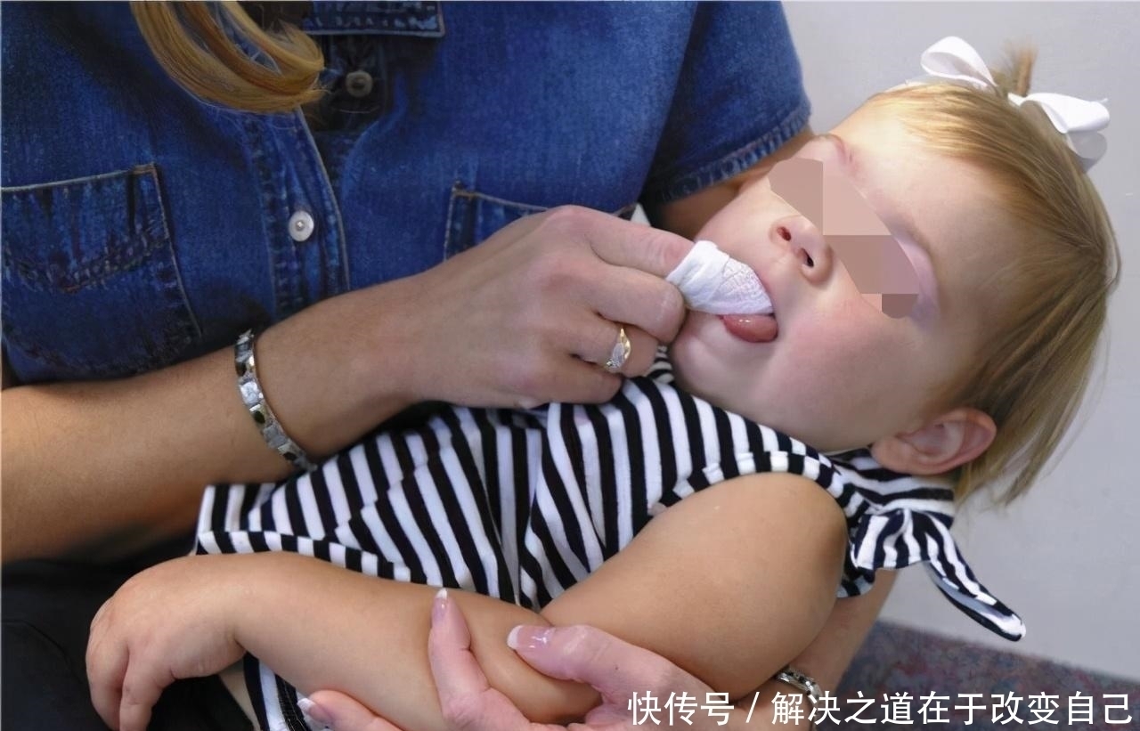 牙床|宝宝半夜发热,宝妈火急火燎送医院,医生扒开嘴一看:可以回家了