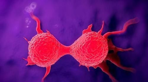 发财树发黄还烂根?水浇错了,换个浇法呼呼疯长,植株苍劲挺拔