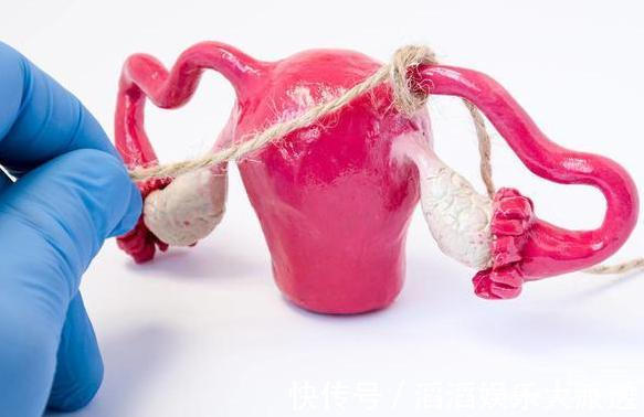 精子|女性选择“结扎”之后,还会有生理需要吗这点可能很多人想不到