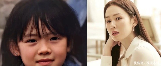 鼻尖抬高,鼻翼惊现疤痕,号称天然美女代名词的她,也翻车了?