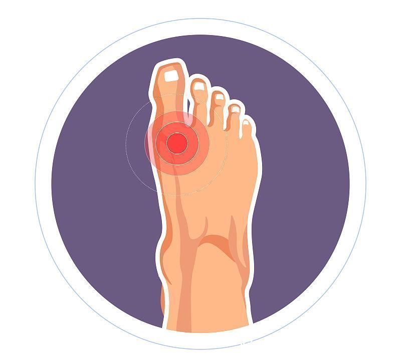 秘诀|真正降尿酸的四个秘诀,多喝水排在第二位,排在首位的你很少坚持