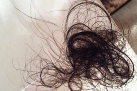 出现这5个现象,有可能会脱发每天5分钟,让毛囊恢复掉发回来