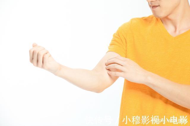 肝癌|身体两处“发痒”,别误以为是过敏了,或是肝癌的征兆,需警惕
