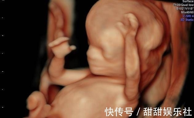 性别|为什么有些医院做四维彩超不让家属陪同这些原因,大家有权知道