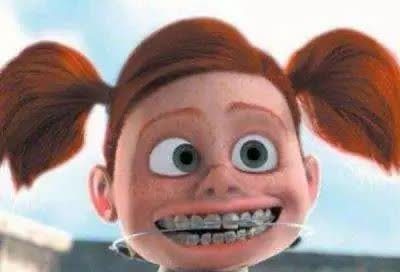 黄金期|孩子牙齿矫正,必须要12岁以后吗?你是否错过了孩子的矫正黄金期