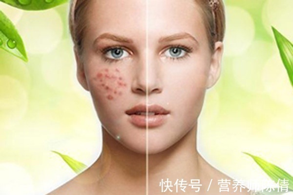 肌肤|毛孔粗大成难题:女生毛孔粗大真的没救了吗?