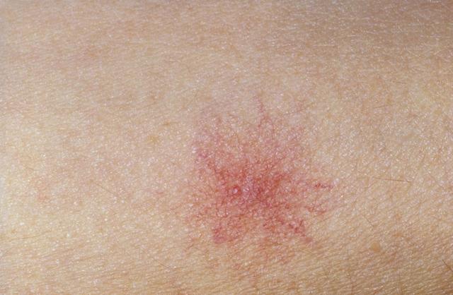 体检|体检报告3个指标正常，也没有6个症状，恭喜你的肝脏很健康