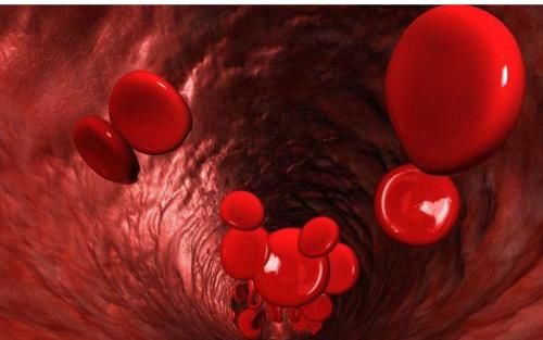 血管堵塞|血液黏稠的人，脸上会有4个表现，若没有，说明血管还不算太堵