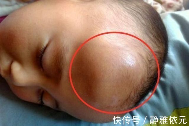 婆婆|1岁宝宝摔下床,妈妈的做法让婆婆直呼冷血,医生却说:做的对